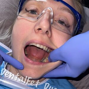 dentalfet_duo